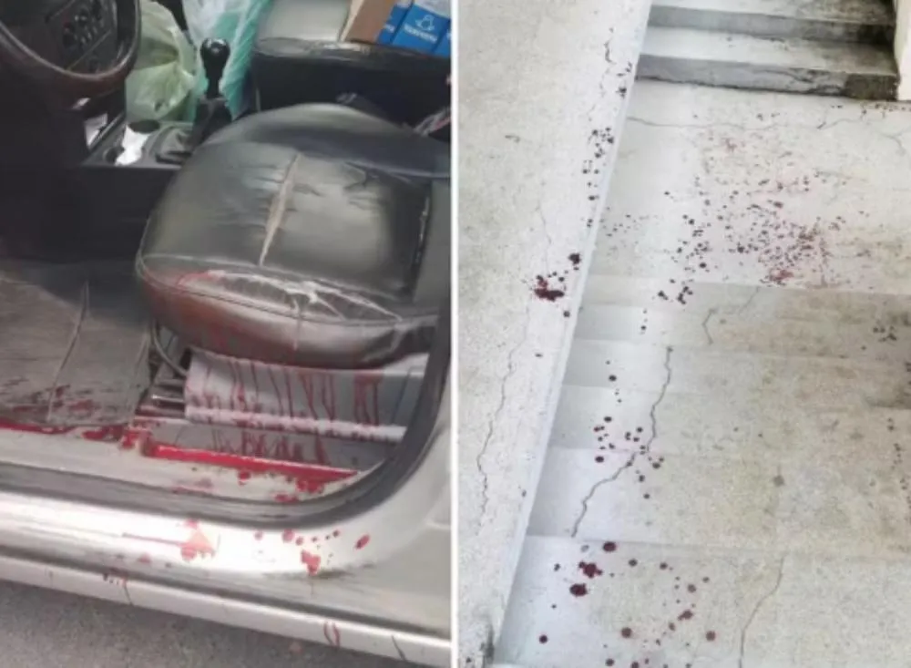 Motorista é atacado com facão após briga no trânsito em Registro (SP), tem nervo e artéria rompidos e dirige ferido até delegacia / Foto: Arquvo Pessoal