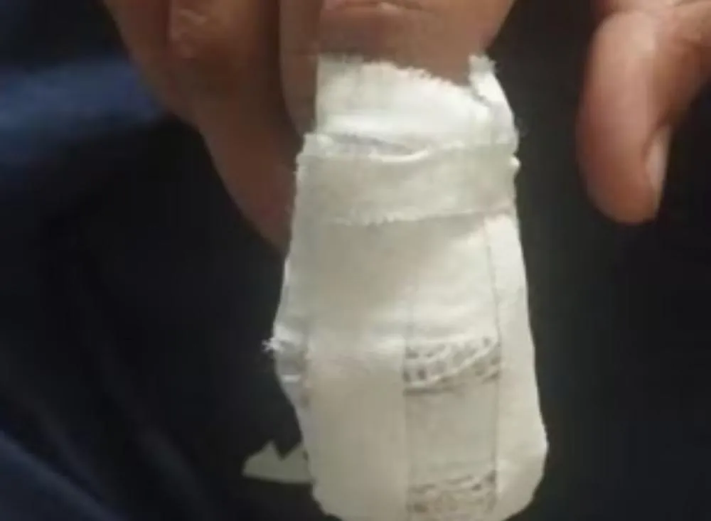 Menina tem dedo decepado após mão ficar prensada em porta de escola estadual em Registro (SP) / Foto: Reprodução